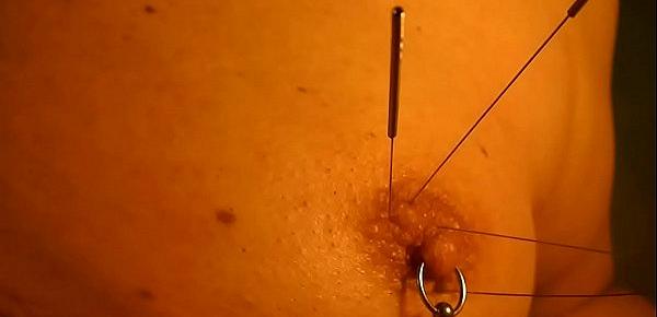  Play piercing with acupuncture needles